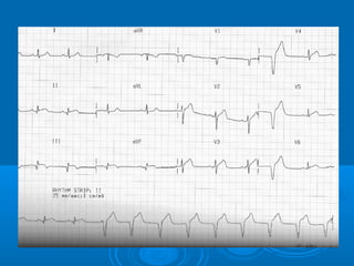 Ec gs  for medical student