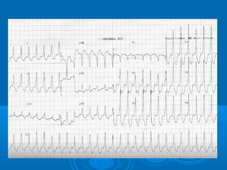 Ec gs  for medical student