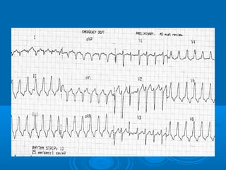 Ec gs  for medical student