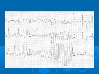 Ec gs  for medical student