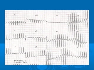 Ec gs  for medical student