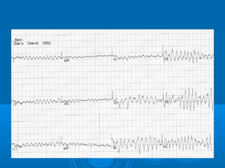 Ec gs  for medical student
