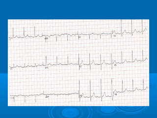 Ec gs  for medical student