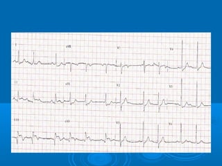 Ec gs  for medical student