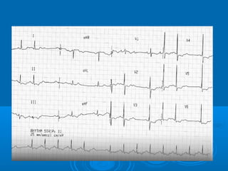 Ec gs  for medical student