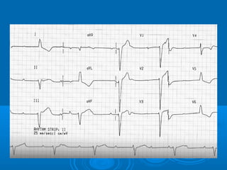 Ec gs  for medical student