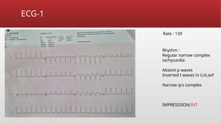 ECG sick sinus syndrome in emergency dept .pptx