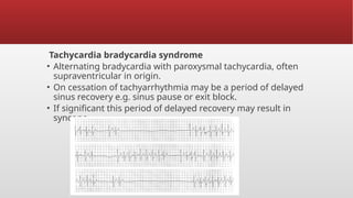 ECG sick sinus syndrome in emergency dept .pptx