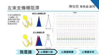 心電圖競賽心電圖介紹我是誰 心電圖未來
陳在民 專案處-顧問
LBBB
左束支傳導阻滯
12
左束支傳導阻滯
（LBBB）時，
增寬的RR’波群
在V6導聯上表
現最為典型。
 