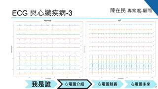 心電圖競賽心電圖介紹我是誰 心電圖未來
陳在民 專案處-顧問
ECG 與心臟疾病-3
13
Normal AF
 