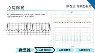 心電圖競賽心電圖介紹我是誰 心電圖未來
陳在民 專案處-顧問
AF
心房顫動
14
AF ( atrial fibrillation )心房顫動(60/分<心跳<100/
分)(沒明顯P波(亂抖)，R-R不規則)
 