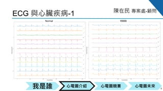 心電圖競賽心電圖介紹我是誰 心電圖未來
陳在民 專案處-顧問
ECG 與心臟疾病-1
9
Normal RBBB
 