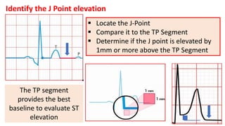 Jpoint Elev Ec gs in ami | PDF