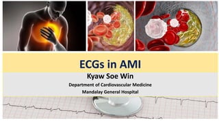 ECGs in AMI
Kyaw Soe Win
Department of Cardiovascular Medicine
Mandalay General Hospital
 