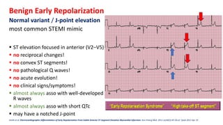 Pericarditis
•Diffuse, nonlocalized ST elevation,
often in all leads except V1 and aVR
(which will be depressed instead)
•...