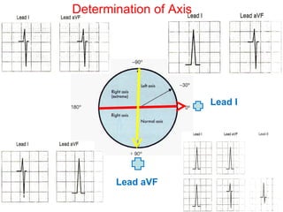Ecg skills enhancement | PPT