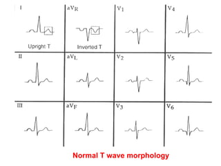 Ecg skills enhancement | PPT