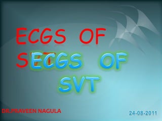 ECGS  OF    SVT   ECGS  OF    SVT   DR.PRAVEEN NAGULA 24-08-2011 