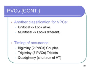 Ecg step by step not by me | PPTX