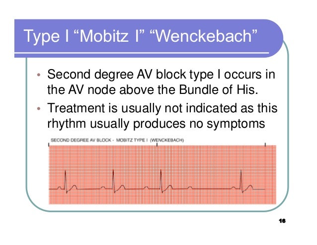 Ecg step by step not by me