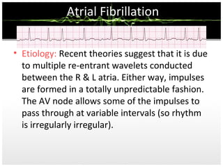 Ecg step y step 2015 hashem | PPT