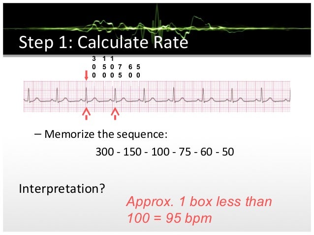 Ecg Step Y Step 15 Hashem Ecg Step Y Step 15 Hashem