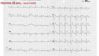 Homme 28 ans… mis à l’UHCD
 