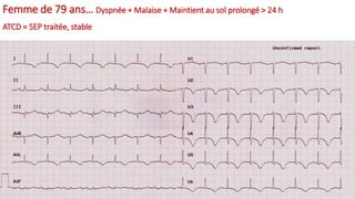 Femme de 79 ans… Dyspnée + Malaise + Maintient au sol prolongé > 24 h
ATCD = SEP traitée, stable
 