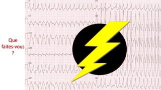 A.1-1
Que
faites-vous
?
 