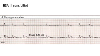 BSA III sensibilisé
 