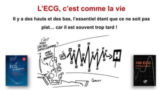 L’ECG, c’est comme la vie
Il y a des hauts et des bas, l’essentiel étant que ce ne soit pas
plat… car il est souvent trop tard !
 