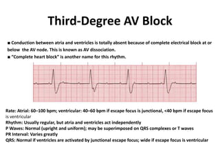 Third-Degree AV Block
■ Conduction between atria and ventricles is totally absent because of complete electrical block at or
below the AV node. This is known as AV dissociation.
■ “Complete heart block” is another name for this rhythm.
Rate: Atrial: 60–100 bpm; ventricular: 40–60 bpm if escape focus is junctional, <40 bpm if escape focus
is ventricular
Rhythm: Usually regular, but atria and ventricles act independently
P Waves: Normal (upright and uniform); may be superimposed on QRS complexes or T waves
PR Interval: Varies greatly
QRS: Normal if ventricles are activated by junctional escape focus; wide if escape focus is ventricular
 