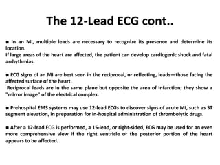 The 12-Lead ECG cont..
■ In an MI, multiple leads are necessary to recognize its presence and determine its
location.
If large areas of the heart are affected, the patient can develop cardiogenic shock and fatal
arrhythmias.
■ ECG signs of an MI are best seen in the reciprocal, or reflecting, leads—those facing the
affected surface of the heart.
Reciprocal leads are in the same plane but opposite the area of infarction; they show a
"mirror image" of the electrical complex.
■ Prehospital EMS systems may use 12-lead ECGs to discover signs of acute MI, such as ST
segment elevation, in preparation for in-hospital administration of thrombolytic drugs.
■ After a 12-lead ECG is performed, a 15-lead, or right-sided, ECG may be used for an even
more comprehensive view if the right ventricle or the posterior portion of the heart
appears to be affected.
 