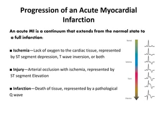 Progression of an Acute Myocardial
Infarction
An acute MI is a continuum that extends from the normal state to
a full infarction:
■ Ischemia—Lack of oxygen to the cardiac tissue, represented
by ST segment depression, T wave inversion, or both
■ Injury—Arterial occlusion with ischemia, represented by
ST segment Elevation
■ Infarction—Death of tissue, represented by a pathological
Q wave
 