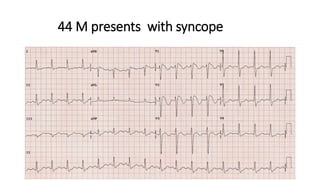 44 M presents with syncope
 