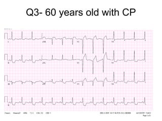 Q3- 60 years old with CP

 