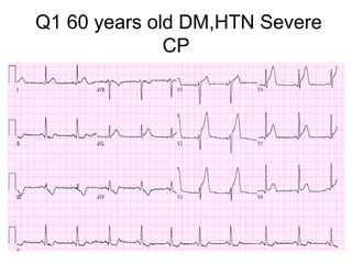 Q1 60 years old DM,HTN Severe
CP

 