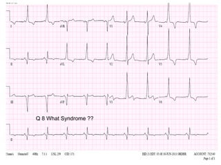Q 8 What Syndrome ??

 