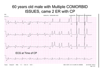 60 years old male with Multiple COMORBID
ISSUES, came 2 ER with CP

ECG at Time of CP

 