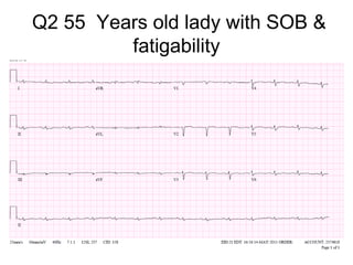 Q2 55 Years old lady with SOB &
fatigability

 