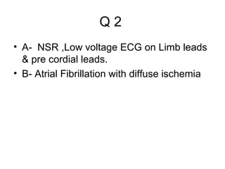 Q2
• A- NSR ,Low voltage ECG on Limb leads
& pre cordial leads.
• B- Atrial Fibrillation with diffuse ischemia

 