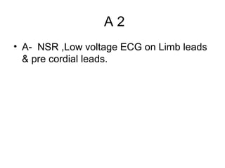 A2
• A- NSR ,Low voltage ECG on Limb leads
& pre cordial leads.

 