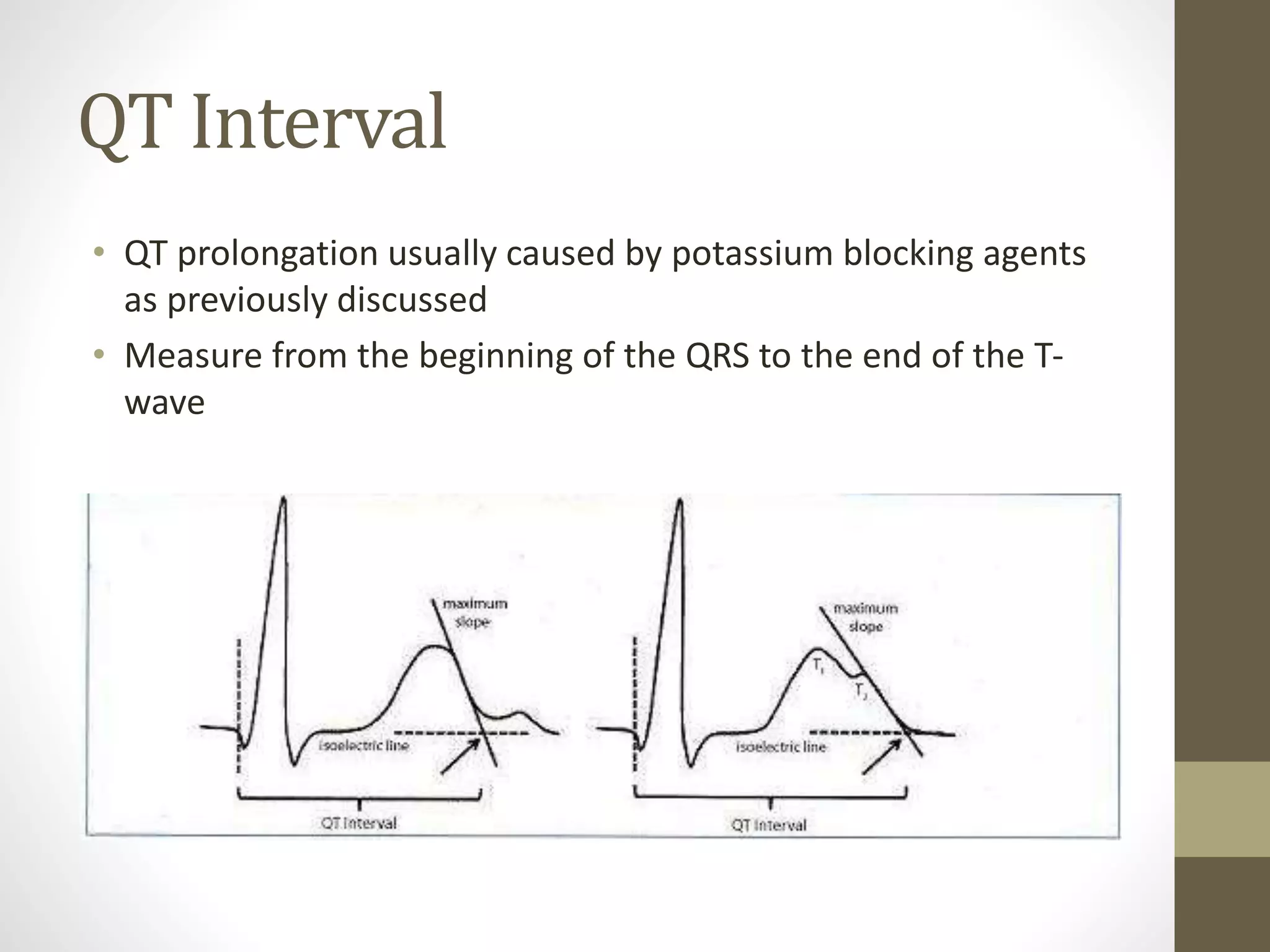 QT Interval
• QT prolongation usually caused by potassium blocking agents
as previously discussed
• Measure from the beginning of the QRS to the end of the T-
wave
 