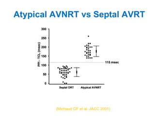 Atypical AVNRT vs Septal AVRT (Michaud GF et al. JACC 2001) 