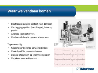 Waar we vandaan komen Electrocardiografie bestaat ruim 100 jaarVastlegging op film (hartfilmpje), later op papierAnaloge (pen)schrijversVeel verschillende presentatievormenTegenwoordig:Gestandaardiseerde ECG afleidingenVaak dezelfde presentatievormdigitaal afdrukken op thermisch papierVoorkeur voor A4 formaat
