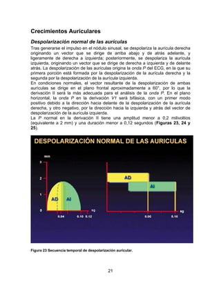 Crecimientos Auriculares
Despolarización normal de las aurículas
Tras generarse el impulso en el nódulo sinusal, se despolariza la aurícula derecha
originando un vector que se dirige de arriba abajo y de atrás adelante, y
ligeramente de derecha a izquierda; posteriormente, se despolariza la aurícula
izquierda, originando un vector que se dirige de derecha a izquierda y de delante
atrás. La despolarización de las aurículas origina la onda P del ECG, en la que su
primera porción está formada por la despolarización de la aurícula derecha y la
segunda por la despolarización de la aurícula izquierda.
En condiciones normales, el vector resultante de la despolarización de ambas
aurículas se dirige en el plano frontal aproximadamente a 60°, por lo que la
derivación II será la más adecuada para el análisis de la onda P. En el plano
horizontal, la onda P en la derivación V1 será bifásica, con un primer modo
positivo debido a la dirección hacia delante de la despolarización de la aurícula
derecha, y otro negativo, por la dirección hacia la izquierda y atrás del vector de
despolarización de la aurícula izquierda.
La P normal en la derivación II tiene una amplitud menor a 0,2 milivoltios
(equivalente a 2 mm) y una duración menor a 0,12 segundos (Figuras 23, 24 y
25).




Figura 23 Secuencia temporal de despolarización auricular.




                                            21
 