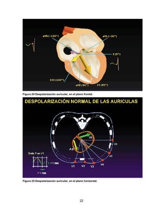 Figura 24 Despolarización auricular, en el plano frontal.




Figura 25 Despolarización auricular, en el plano horizontal.




                                              22
 