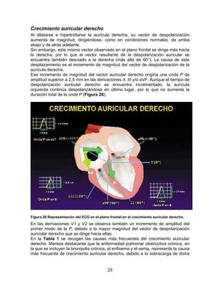 Crecimiento auricular derecho
Al dilatarse e hipertrofiarse la aurícula derecha, su vector de despolarización
aumenta de magnitud, dirigiéndose, como en condiciones normales, de arriba
abajo y de atrás adelante.
Sin embargo, este mismo vector observado en el plano frontal se dirige más hacia
la derecha, por lo que el vector resultante de la despolarización auricular se
encuentra también desviado a la derecha (más alta de 60°). La causa de este
desplazamiento es el incremento de magnitud del vector de despolarización de la
aurícula derecha.
Ese incremento de magnitud del vector auricular derecho origina una onda P de
amplitud superior a 2,5 mm en las derivaciones II, III y/o aVF. Aunque el tiempo de
despolarización auricular derecho se encuentra incrementado, la aurícula
izquierda continúa despolarizándose en último lugar, por lo que no aumenta la
duración total de la onda P (Figura 26).




Figura 26 Representación del ECG en el plano frontal en el crecimiento auricular derecho.
En las derivaciones V1 y V2 se observa también un incremento de amplitud del
primer modo de la P, debido a la mayor magnitud del vector de despolarización
auricular derecho que se dirige hacia ellas.
En la Tabla 1 se recogen las causas más frecuentes del crecimiento auricular
derecho. Merece destacarse que la enfermedad pulmonar obstructiva crónica, en
la que se incluyen la bronquitis crónica, el enfisema y el asma, representa la causa
más frecuente de crecimiento auricular derecho, debido a la sobrecarga de dicha


                                            23
 