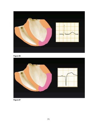 Figura 86




Figura 87




            71
 