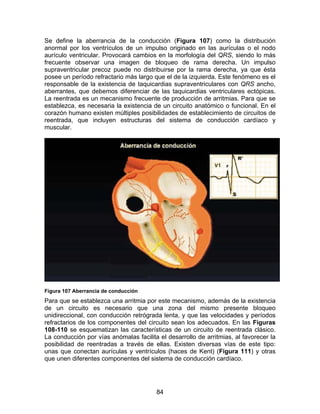 Se define la aberrancia de la conducción (Figura 107) como la distribución
anormal por los ventrículos de un impulso originado en las aurículas o el nodo
aurículo ventricular. Provocará cambios en la morfología del QRS, siendo lo más
frecuente observar una imagen de bloqueo de rama derecha. Un impulso
supraventricular precoz puede no distribuirse por la rama derecha, ya que ésta
posee un período refractario más largo que el de la izquierda. Este fenómeno es el
responsable de la existencia de taquicardias supraventriculares con QRS ancho,
aberrantes, que debemos diferenciar de las taquicardias ventriculares ectópicas.
La reentrada es un mecanismo frecuente de producción de arritmias. Para que se
establezca, es necesaria la existencia de un circuito anatómico o funcional. En el
corazón humano existen múltiples posibilidades de establecimiento de circuitos de
reentrada, que incluyen estructuras del sistema de conducción cardíaco y
muscular.




Figura 107 Aberrancia de conducción
Para que se establezca una arritmia por este mecanismo, además de la existencia
de un circuito es necesario que una zona del mismo presente bloqueo
unidireccional, con conducción retrógrada lenta, y que las velocidades y períodos
refractarios de los componentes del circuito sean los adecuados. En las Figuras
108-110 se esquematizan las características de un circuito de reentrada clásico.
La conducción por vías anómalas facilita el desarrollo de arritmias, al favorecer la
posibilidad de reentradas a través de ellas. Existen diversas vías de este tipo:
unas que conectan aurículas y ventrículos (haces de Kent) (Figura 111) y otras
que unen diferentes componentes del sistema de conducción cardíaco.




                                        84
 